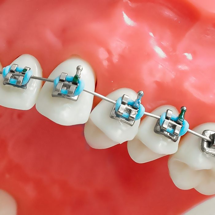 نازنین تراب‌زاده طاری